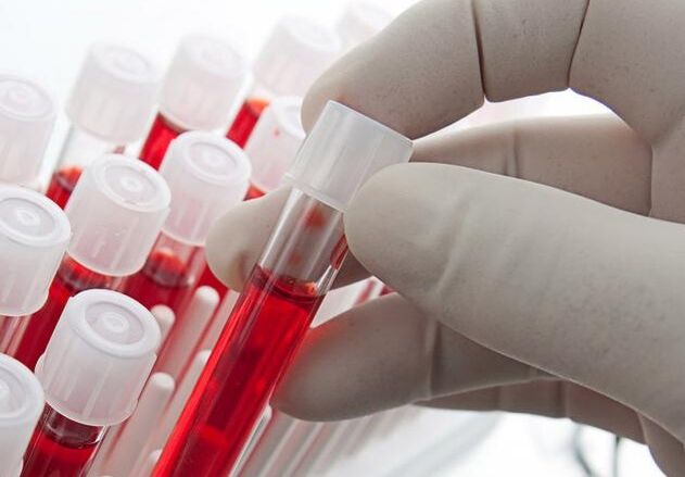 bloedonderzoek na het drinken van alcohol